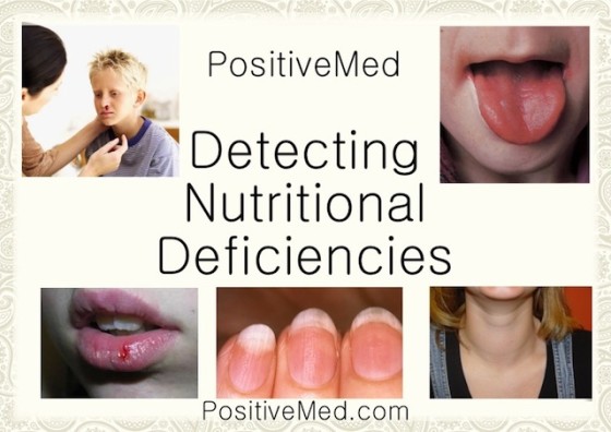 Health - Detecting Nutritional Deficiencies