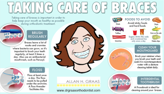 Taking-care-of-braces-large