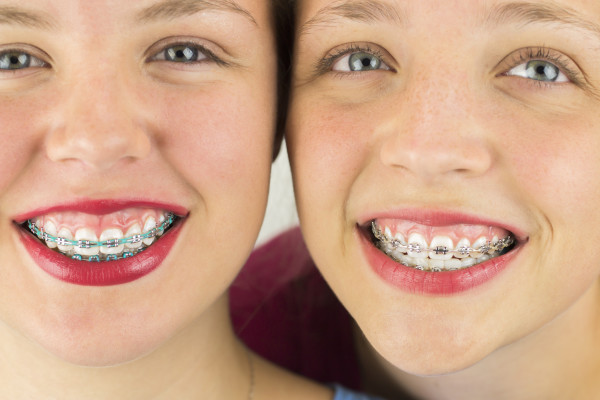 two cute twin girls wearing braces