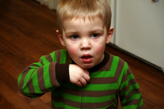 keep up with your kid's runny nose - a toddler dealing with a runny nose