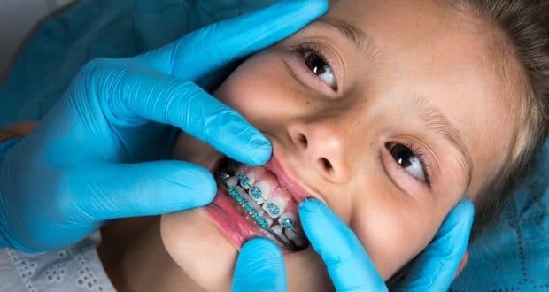 Tips to prepare your child for braces- a girl getting her braces fixed