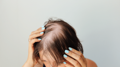 Modern hair loss treatments - a woman with thinning hair