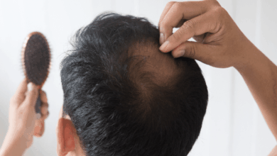 Effective Tips For Thinning Hair - a man examining the bald spot at the top of his head